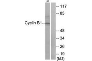 Western blot analysis of extracts from Jurkat cells, treated with UV 15', using Cyclin B1 (Ab-147) Antibody. (Cyclin B1 抗体  (AA 121-170))