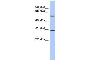 WB Suggested Anti-RELB Antibody Titration:  0. (RELB 抗体  (Middle Region))