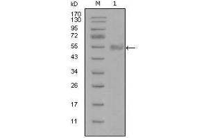 Western Blot showing SYT1 antibody used against truncated Trx-SYT1 recombinant protein (1). (SYT1 抗体)