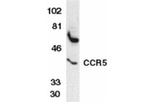 Image no. 2 for anti-Chemokine (C-C Motif) Receptor 5 (CCR5) (AA 6-20) antibody (ABIN319017) (CCR5 抗体  (AA 6-20))