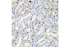 Immunohistochemistry of paraffin-embedded mouse kidney using TUSC2 antibody (ABIN5974256) at dilution of 1/200 (40x lens). (TUSC2 抗体)