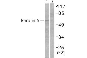 Western Blotting (WB) image for anti-Keratin 5 (KRT5) (C-Term) antibody (ABIN1848638) (Cytokeratin 5 抗体  (C-Term))