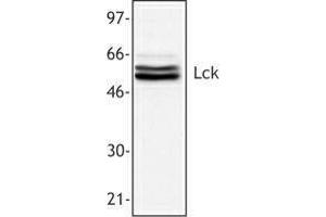 Western Blotting (WB) image for anti-Lymphocyte-Specific Protein tyrosine Kinase (LCK) antibody (ABIN2665225) (LCK 抗体)