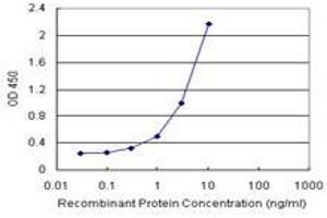 Sandwich ELISA detection sensitivity ranging from 0. (COMMD1 (人) Matched Antibody Pair)