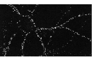 PSD95 Immunohistochemistry Immunocytochemistry of Mouse anti-PSD95 antibody. (DLG4 抗体)