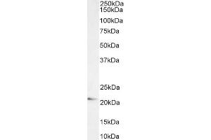 Western Blotting (WB) image for anti-ADP-Ribosylation-Like Factor 6 Interacting Protein 5 (Arl6ip5) (C-Term) antibody (ABIN184829)