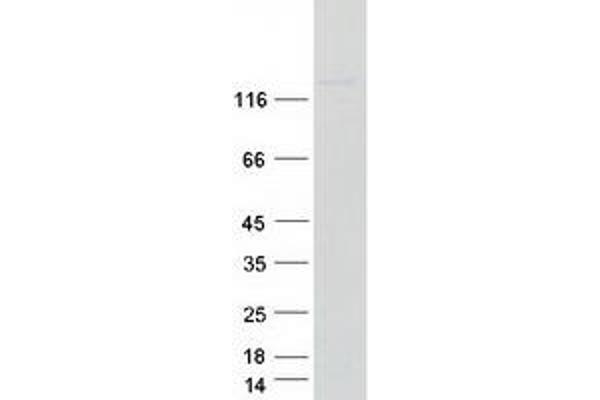 NUP155 Protein (Transcript Variant 1) (Myc-DYKDDDDK Tag)