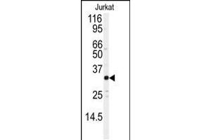 Western blot analysis of anti-JUND Antibody (S255) in Jurkat cell line lysates (35ug/lane) (JunD 抗体  (AA 233-262))
