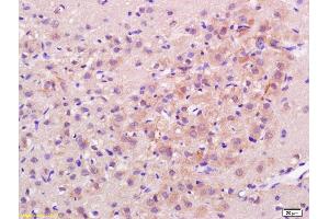 Formalin-fixed and paraffin embedded rat brain labeled with Rabbit Anti H Cadherin/T cadherin Polyclonal Antibody, Unconjugated (ABIN715271) at 1:200 followed by conjugation to the secondary antibody and DAB staining (Cadherin 13 抗体  (AA 301-400))