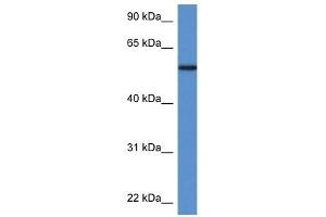 Phosphoglucomutase 5 抗体  (N-Term)