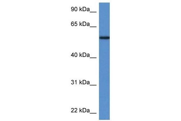 Phosphoglucomutase 5 抗体  (N-Term)