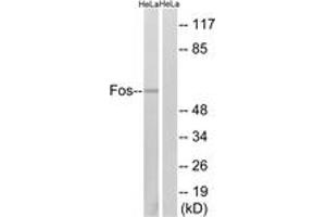 Western blot analysis of extracts from HeLa cells, using Fos (Ab-374) Antibody. (c-FOS 抗体  (AA 331-380))