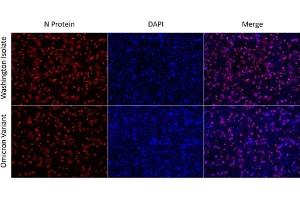 Immunofluorescence (IF) image for anti-SARS-Coronavirus Nucleocapsid Protein (SARS-CoV N) antibody (ABIN6952544)