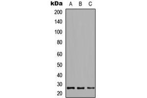 Western blot analysis of CRIF1 expression in HeLa (A), NS-1 (B), PC12 (C) whole cell lysates. (GADD45GIP1 抗体  (Center))