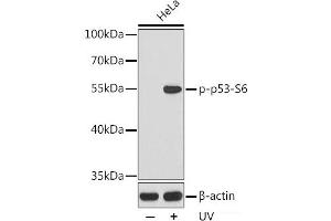 Western blot analysis of extracts from HeLa cells using Phospho-p53(S6) Polyclonal Antibody. (p53 抗体  (pSer6))