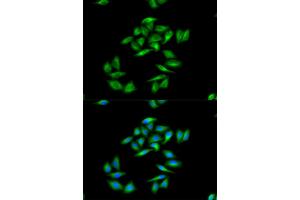 Immunofluorescence analysis of MCF-7 cells using CPT1A antibody. (CPT1A 抗体)