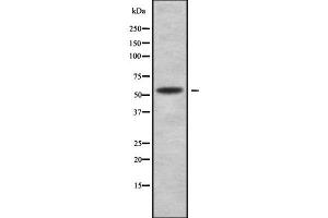 Western blot analysis SERPINF2 using HuvEc whole cell lysates (alpha 2 Antiplasmin 抗体  (C-Term))