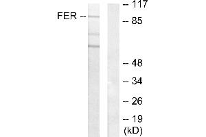 Western blot analysis of extracts from HeLa cells, using FER antibody. (FER 抗体)