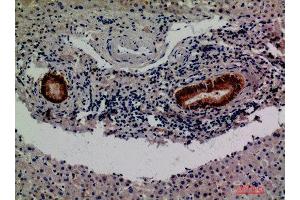 Immunohistochemistry (IHC) analysis of paraffin-embedded Human Liver, antibody was diluted at 1:200. (F13B 抗体)