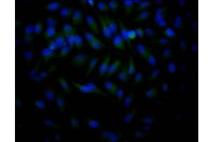 Immunofluorescence (IF) image for anti-Histone Deacetylase 2 (HDAC2) antibody (ABIN7127538)