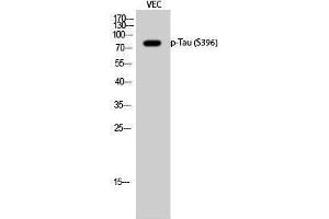 Western Blotting (WB) image for anti-tau Protein (pSer396) antibody (ABIN3172977) (tau 抗体  (pSer396))