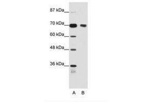 Image no. 1 for anti-Tripartite Motif Containing 32 (TRIM32) (N-Term) antibody (ABIN202853) (TRIM32 抗体  (N-Term))