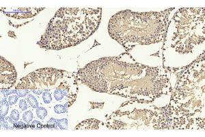 Immunohistochemical analysis of paraffin-embedded mouse testis tissue. (p53 抗体)