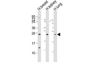 All lanes : Anti-ADM Antibody (Center) at 1:1000-1:2000 dilution Lane 1: human breast lysate Lane 2: human kidney lysate Lane 3: human lung lysate Lysates/proteins at 20 μg per lane. (Adrenomedullin 抗体  (AA 69-96))