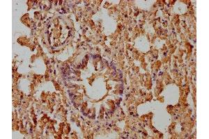 IHC image of ABIN7176993 diluted at 1:400 and staining in paraffin-embedded mouse lung tissue performed on a Leica BondTM system. (beta-2 Microglobulin 抗体  (AA 21-119))