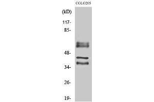 Western Blotting (WB) image for anti-Periphilin 1 (PPHLN1) (Internal Region) antibody (ABIN6283818) (PPHLN1 抗体  (Internal Region))