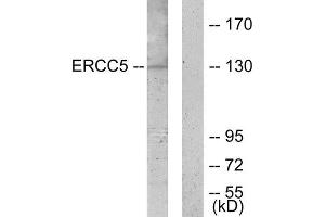 Western Blotting (WB) image for anti-DNA Repair Protein Complementing XP-G Cells (ERCC5) (N-Term) antibody (ABIN1849293) (ERCC5 抗体  (N-Term))