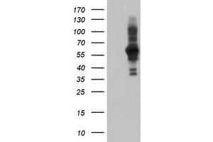 HEK293T cells were transfected with the pCMV6-ENTRY control (Left lane) or pCMV6-ENTRY PDLIM5 (Right lane) cDNA for 48 hrs and lysed. (PDLIM5 抗体)