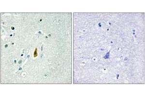 Immunohistochemistry analysis of paraffin-embedded human brain, using p53 (Phospho-Thr81) Antibody. (p53 抗体  (pThr81))