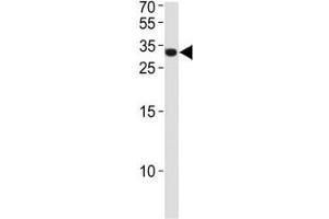 ASCL1 antibody western blot analysis in NCI-H460 lysate. (ASCL1 抗体  (AA 63-90))