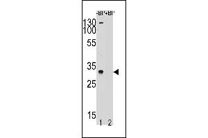 Western blot analysis of TSPY Antibody pre-incubated without(lane 1) and with(lane 2) blocking peptide in LNCAP cell line lysate. (TSPY1 抗体  (C-Term))