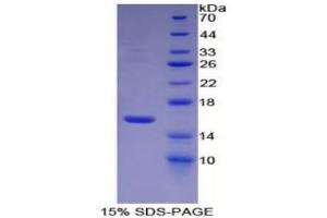 SDS-PAGE (SDS) image for Coagulation Factor VII (F7) ELISA Kit (ABIN6574291)