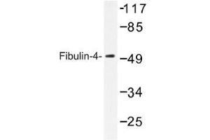 Image no. 1 for anti-Fibulin 4 (FBLN4) antibody (ABIN317833) (FBLN4 抗体)