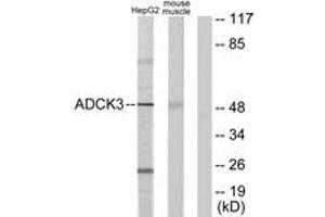 Western Blotting (WB) image for anti-Coenzyme Q8A (COQ8A) (AA 301-350) antibody (ABIN2889684) (COQ8A 抗体  (AA 301-350))