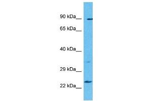 Host: Rabbit Target Name: TBC1D28 Sample Type: Uterus Tumor lysates Antibody Dilution: 1. (TBC1D28 抗体  (Middle Region))