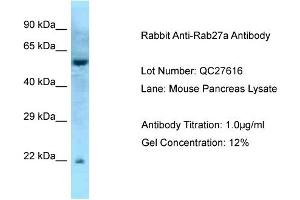 Host: Rabbit Target Name: Rab27a Sample Type: Mouse Pancreas Antibody Dilution: 1. (RAB27A 抗体  (Middle Region))