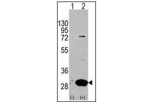 Western blot analysis of Latexin (arrow) in 293 cell lysates (2 µg/lane) either nontransfected (Lane 1) or transiently transfected with the LXN gene (Lane 2) (Latexin 抗体  (Center))