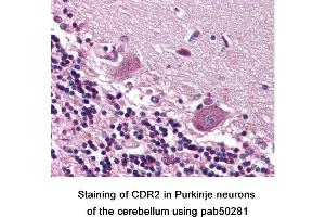 Image no. 1 for anti-Cerebellar Degeneration-Related Protein 2, 62kDa (CDR2) (C-Term) antibody (ABIN363590) (CDR2 抗体  (C-Term))