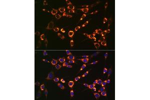 Immunofluorescence analysis of NIH-3T3 cells using PBR/TSPORabbit mAb (ABIN1679051, ABIN3019258, ABIN3019259 and ABIN7101738) at dilution of 1:100 (40x lens). (TSPO 抗体)