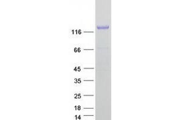 TMEM132A Protein (Transcript Variant 1) (Myc-DYKDDDDK Tag)