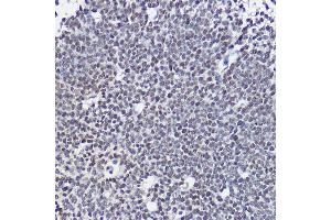 Immunohistochemistry of paraffin-embedded mouse embryos using SOX1 Rabbit pAb (ABIN3017344, ABIN3017345, ABIN3017346 and ABIN1682856) at dilution of 1:25 (40x lens). (SOX1 抗体)