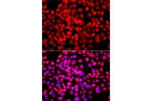 Immunofluorescence analysis of A549 cells using TDP1 antibody (ABIN5975735). (TDP1 抗体)
