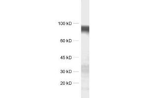 dilution: 1 : 1000, sample: synaptic membrane fraction of rat brain (LP1) (LRRTM4 抗体)