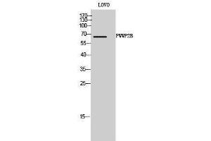 Western Blotting (WB) image for anti-PWWP Domain Containing 2B (PWWP2B) (Internal Region) antibody (ABIN6282515) (PWWP2B 抗体  (Internal Region))