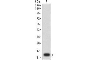 Western blot analysis using CD203C mAb against human CD203C (AA: extra 45-163) recombinant protein. (ENPP3 抗体  (AA 45-163))