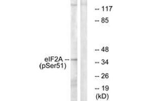 Western Blotting (WB) image for anti-Eukaryotic Translation Initiation Factor 2 Subunit 1 (EIF2S1) (pSer51) antibody (ABIN2888402) (EIF2S1 抗体  (pSer51))